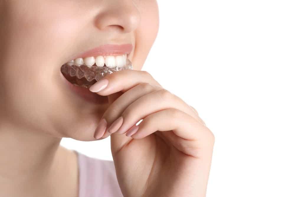 Occlusal splint (night guard)
