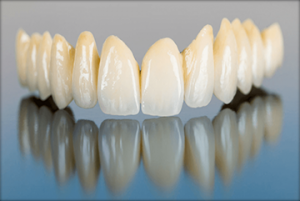 Composite White Fillings