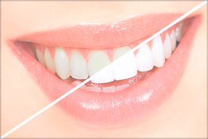 Cosmetic Dentistry