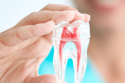 root canal treatment